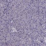 PNMT Antibody in Immunohistochemistry (IHC)