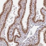 MEPCE Antibody in Immunohistochemistry (IHC)