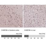 CHMP4B Antibody in Immunohistochemistry (IHC)