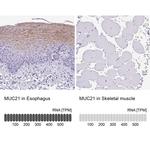 MUC21 Antibody