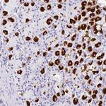 MUC21 Antibody in Immunohistochemistry (IHC)