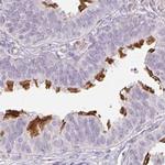 TMEM237 Antibody in Immunohistochemistry (IHC)