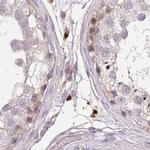 TMEM237 Antibody in Immunohistochemistry (IHC)