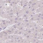 TMEM237 Antibody in Immunohistochemistry (IHC)