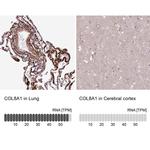 COL8A1 Antibody in Immunohistochemistry (IHC)