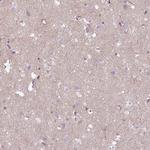 COL8A1 Antibody in Immunohistochemistry (IHC)