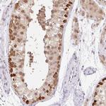 FUSIP1 Antibody in Immunohistochemistry (IHC)