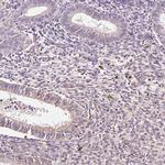 LDHAL6B Antibody in Immunohistochemistry (IHC)