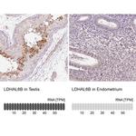 LDHAL6B Antibody