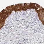 UGT1A6 Antibody in Immunohistochemistry (IHC)