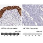 UGT1A6 Antibody