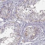 SLCO6A1 Antibody in Immunohistochemistry (IHC)