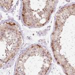 SYNE3 Antibody in Immunohistochemistry (IHC)