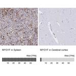 MYO1F Antibody in Immunohistochemistry (IHC)