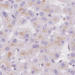 HEXB Antibody in Immunohistochemistry (IHC)