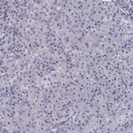 CREB3L3 Antibody in Immunohistochemistry (IHC)