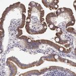 CREB3L3 Antibody in Immunohistochemistry (IHC)