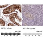 Septin-10 Antibody in Immunohistochemistry (IHC)