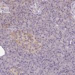 Septin-10 Antibody in Immunohistochemistry (IHC)