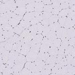 SAM68 Antibody in Immunohistochemistry (IHC)