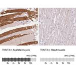 TNNT3 Antibody in Immunohistochemistry (IHC)