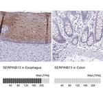 SERPINB13 Antibody