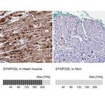 SYNPO2L Antibody in Immunohistochemistry (IHC)