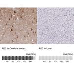 Adenylate Kinase 5 Antibody in Immunohistochemistry (IHC)