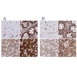 RPS15 Antibody in Immunohistochemistry (IHC)