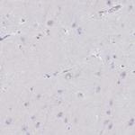 Granulysin Antibody in Immunohistochemistry (IHC)