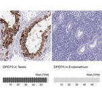 DPEP3 Antibody in Immunohistochemistry (IHC)