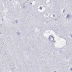 DPEP3 Antibody in Immunohistochemistry (IHC)