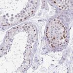 TIPIN Antibody in Immunohistochemistry (IHC)