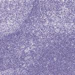 AVIL Antibody in Immunohistochemistry (IHC)