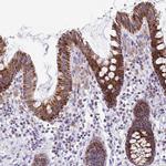 SAMD13 Antibody in Immunohistochemistry (IHC)