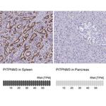 PITPNM3 Antibody in Immunohistochemistry (IHC)