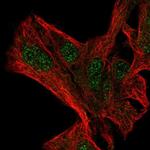 NFXL1 Antibody in Immunocytochemistry (ICC/IF)