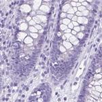 VGAT Antibody in Immunohistochemistry (IHC)