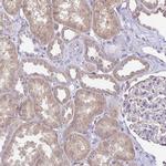 FN3K Antibody in Immunohistochemistry (IHC)