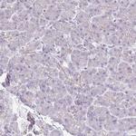 FN3K Antibody in Immunohistochemistry (IHC)