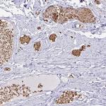 FN3K Antibody in Immunohistochemistry (IHC)