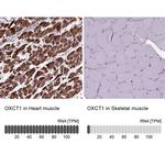 OXCT1 Antibody in Immunohistochemistry (IHC)