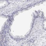 MYPN Antibody in Immunohistochemistry (IHC)