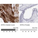 MYPN Antibody