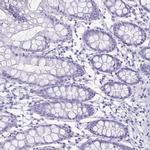 Enkurin Antibody in Immunohistochemistry (IHC)