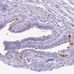 Enkurin Antibody in Immunohistochemistry (IHC)