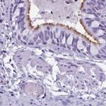 Enkurin Antibody in Immunohistochemistry (IHC)