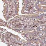 4E-BP2 Antibody in Immunohistochemistry (IHC)