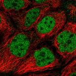 IWS1 Antibody in Immunocytochemistry (ICC/IF)