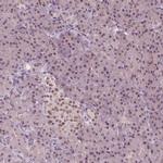 IWS1 Antibody in Immunohistochemistry (IHC)